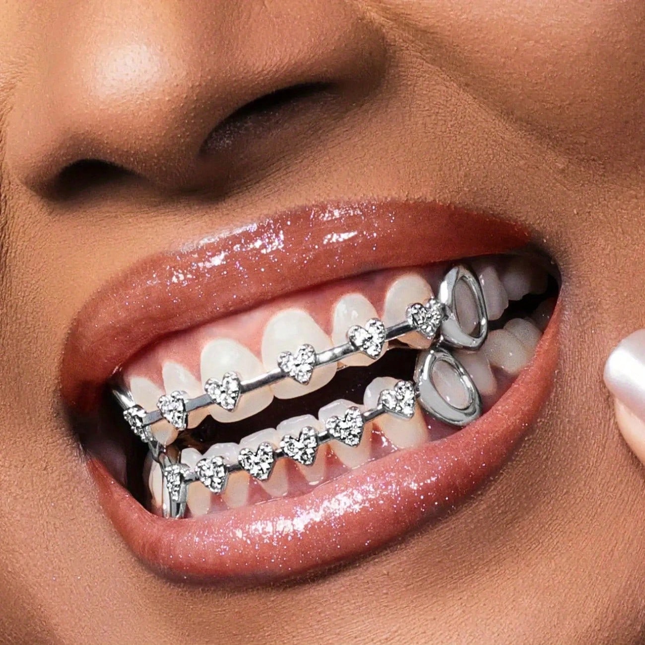 Street Fashion Photography - Hip-Hop Fashion Gold Teeth Micro Inlaid
